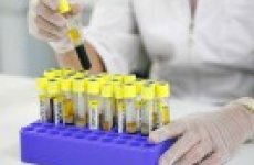 О некоторых результатах работы сотрудников Отделения биотехнологии